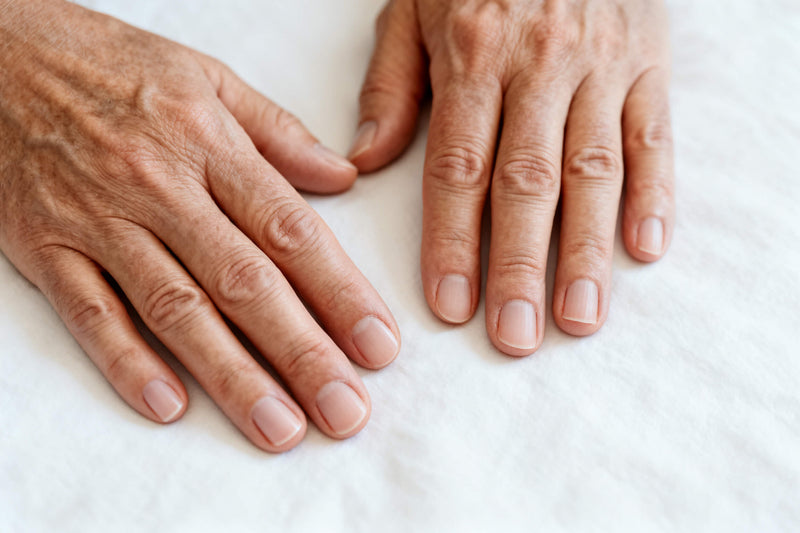 Veränderungen der Fingernägel: Was Flecken, Rillen & Co. bedeuten können