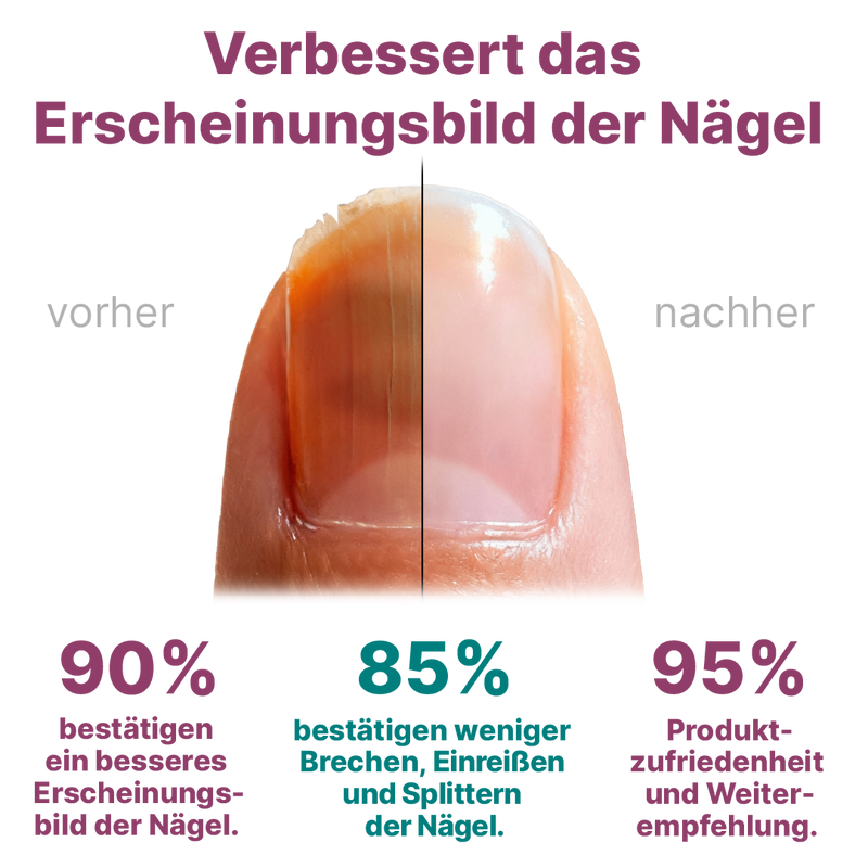 Nagelserum von CT - Image 4