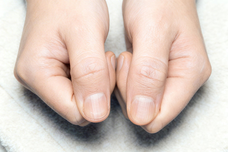 Nahaufnahme natürlicher Fingernägel mit sichtbaren Längs- und Oberflächenrillen. Die Nagelplatte wirkt unruhig strukturiert und wellig. Das Licht betont die unterschiedlichen Linienverläufe auf der Nageloberfläche.