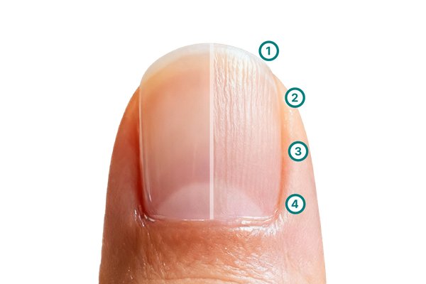 Grafik zum Vergleich zwischen glatter und gerillter Nageloberfläche: Dargestellt sind typische Erscheinungsformen von Nagelrillen wie Längsrillen, feine Oberflächenlinien und ausgeprägtere Strukturveränderungen. Die Illustration zeigt, wie unruhige Wachstumsphasen oder Trockenheit die Nagelplatte sichtbar verändern können.